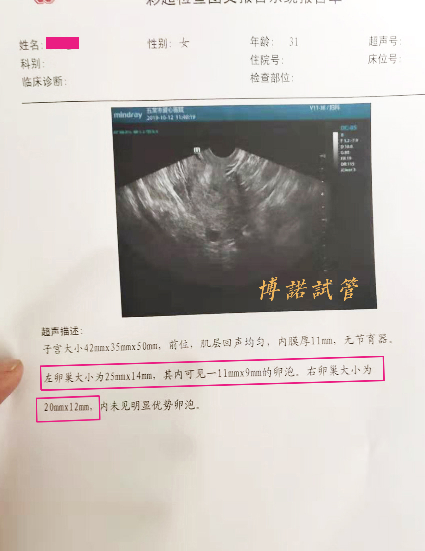 香港借卵试管医院.jpg