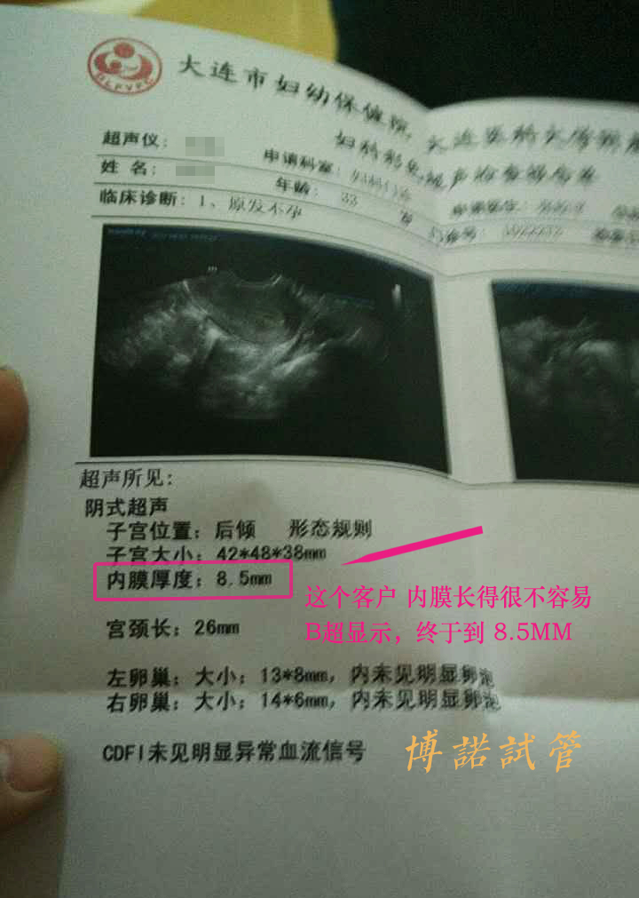 香港借卵试管婴儿.jpg