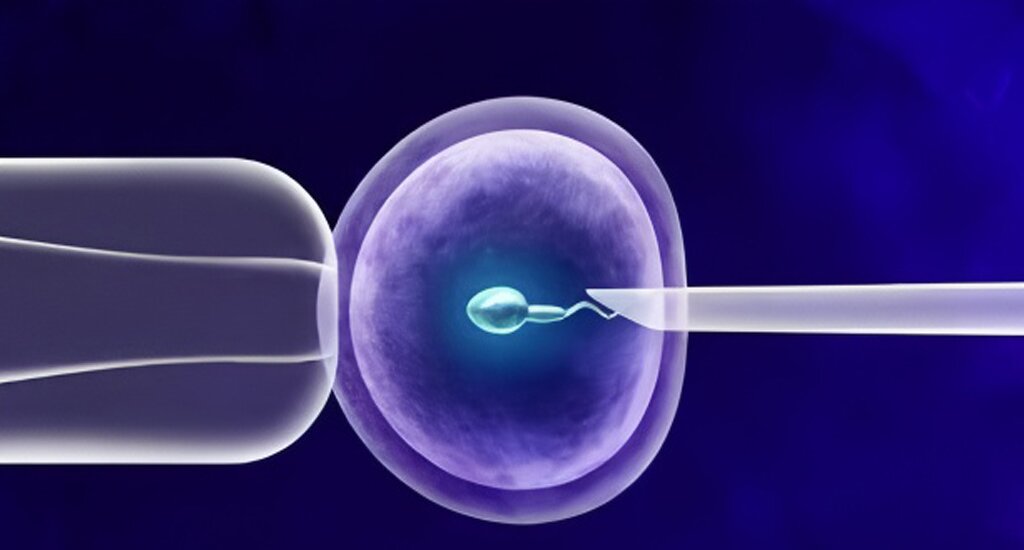 香港借卵：试管成功率：照亮我生命的那束光